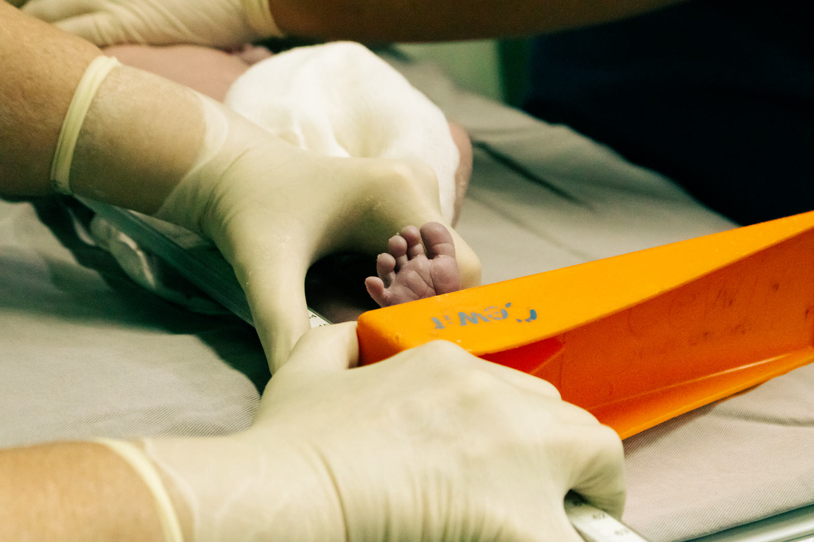 Phototherapy per Day care photograph