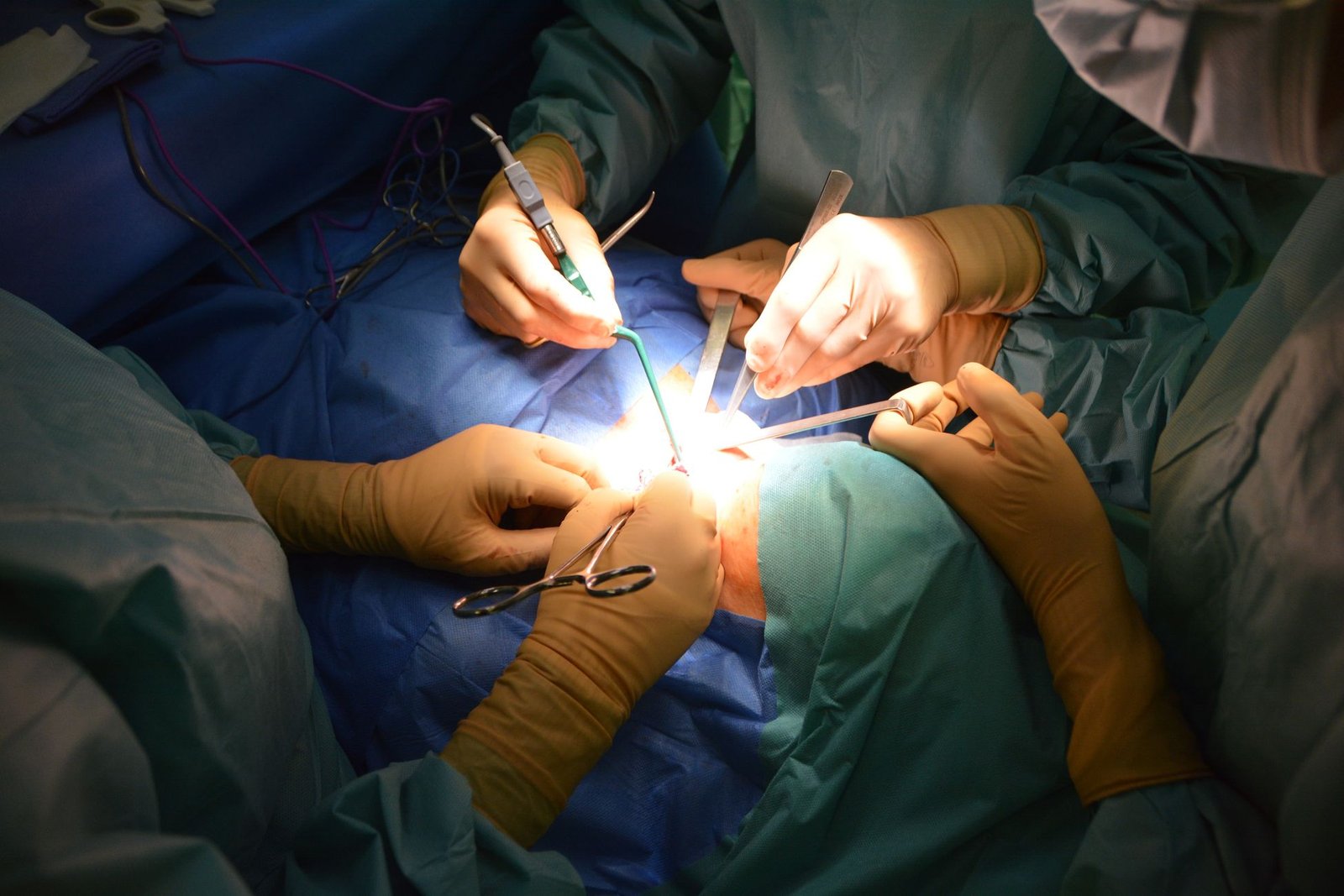 Appendicectomy care photograph