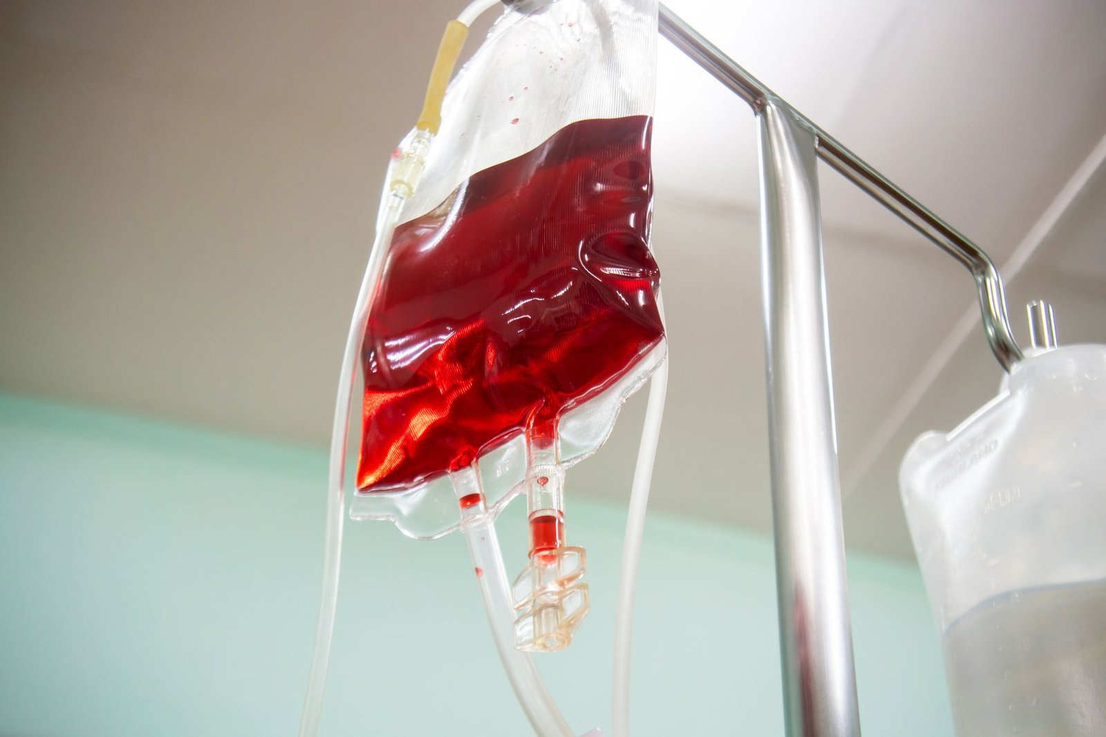 Exchange Blood Transfusion care photograph
