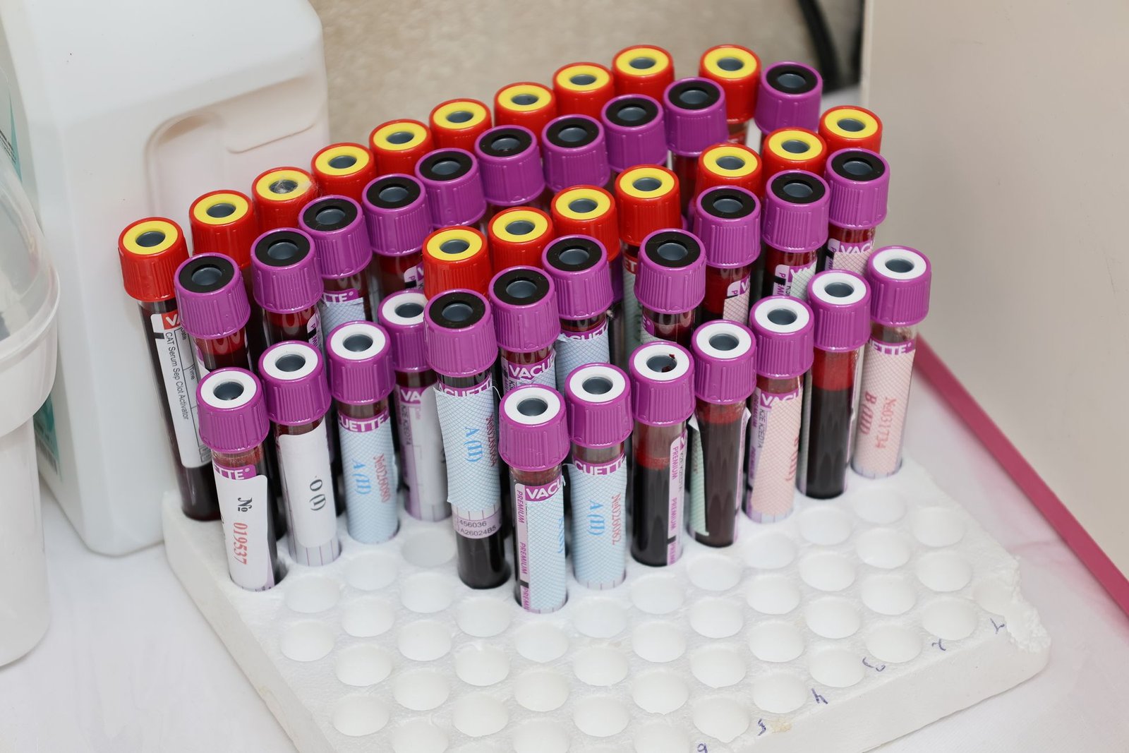 Differential White Cell Count (WBC-DIFF) care photograph