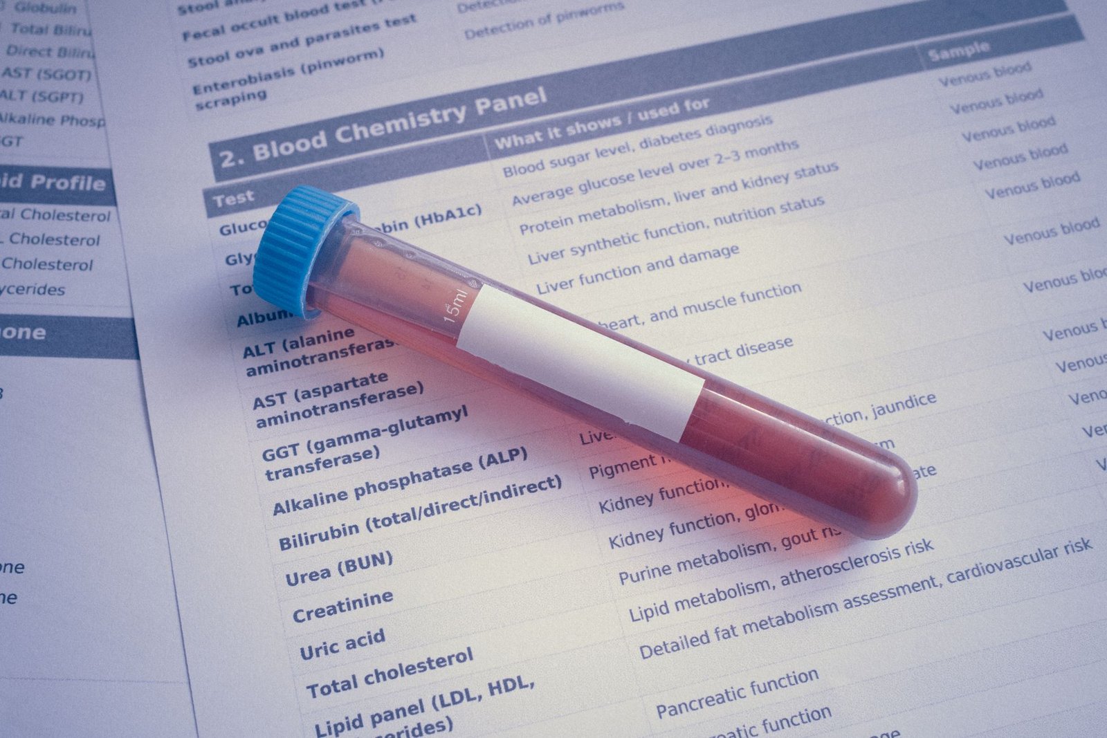 Swab for Microscopy, Culture & Sensitivity care photograph