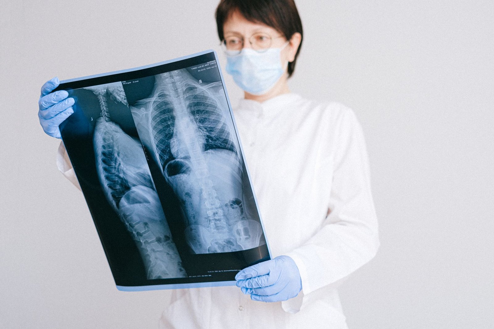 Thoracic X-ray: Sternum care photograph