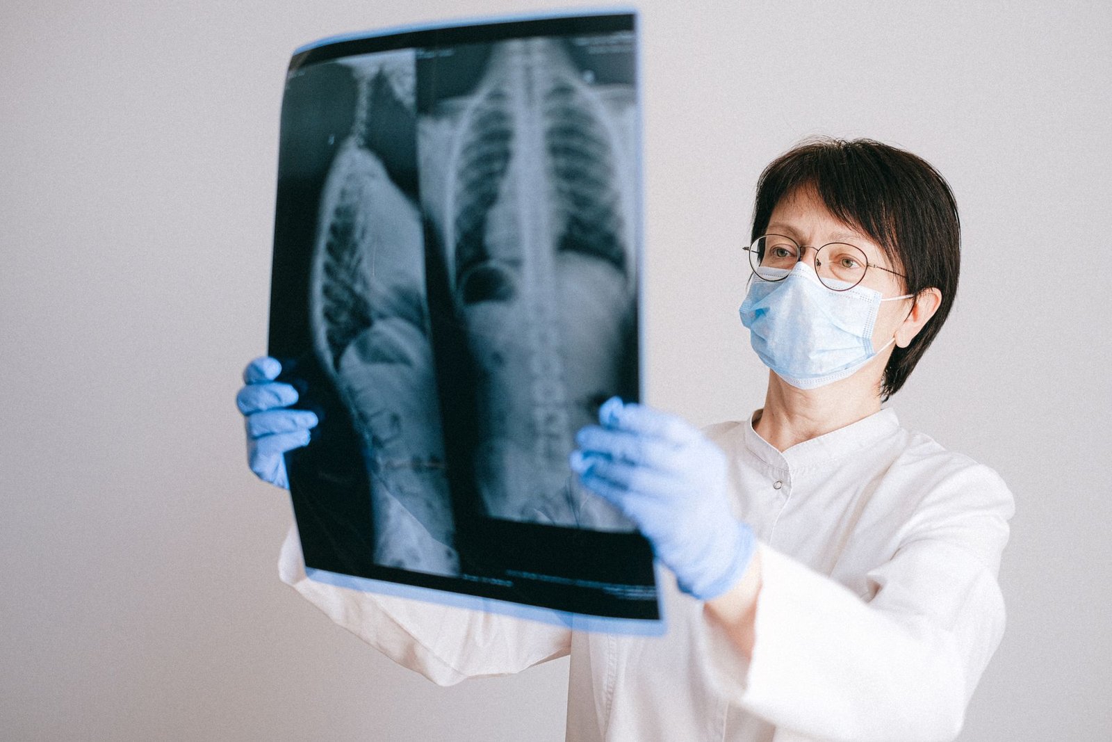 Thoracic X-ray: Apical/Lordotic care photograph
