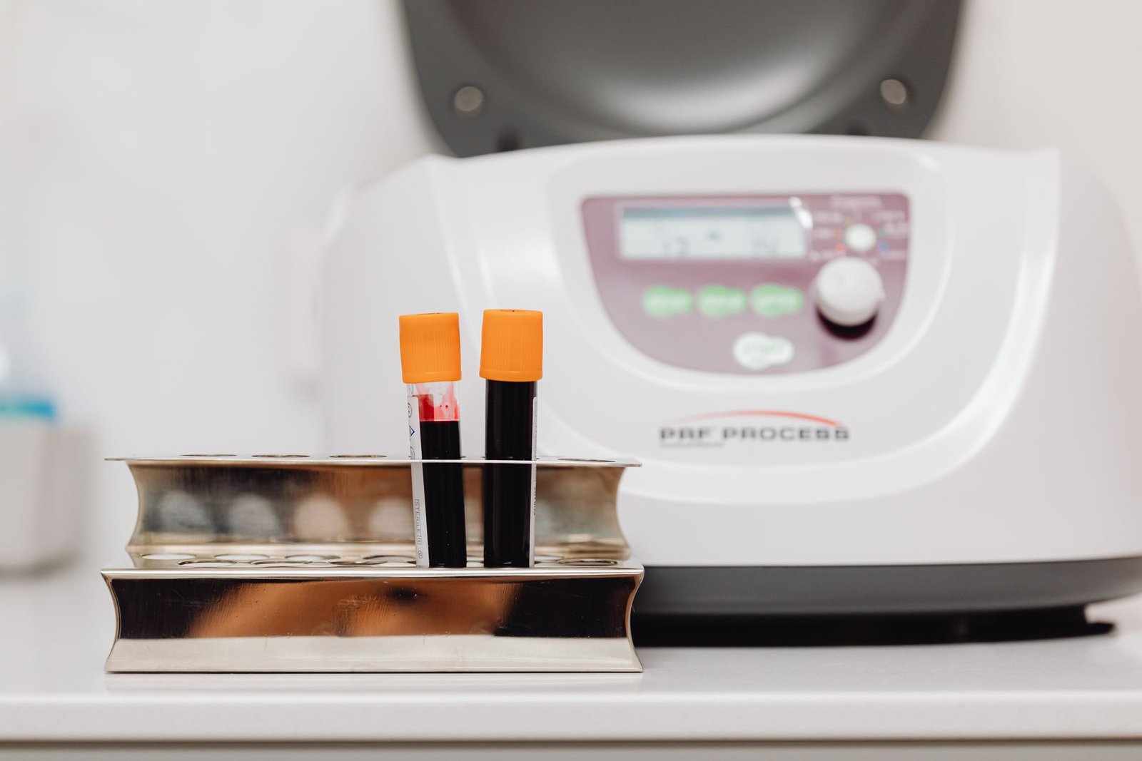 Direct Bilirubin care photograph