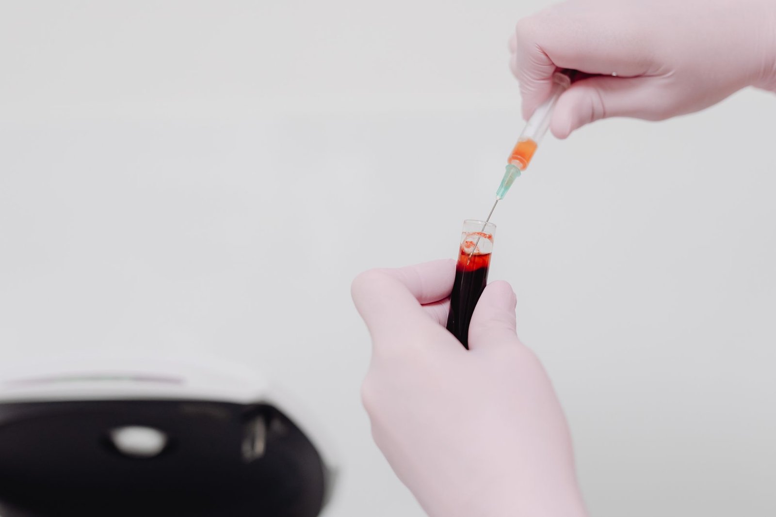 Reticulocyte Count care photograph