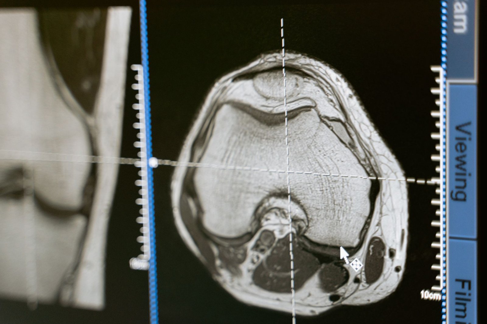 Lower limb X-ray: Knee care photograph